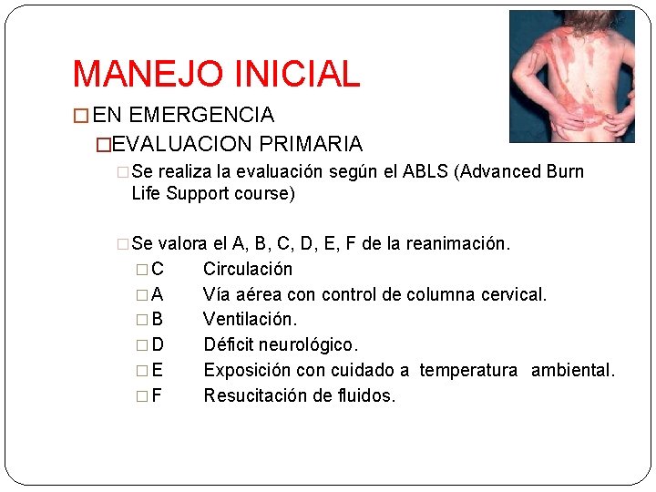 MANEJO INICIAL � EN EMERGENCIA �EVALUACION PRIMARIA �Se realiza la evaluación según el ABLS