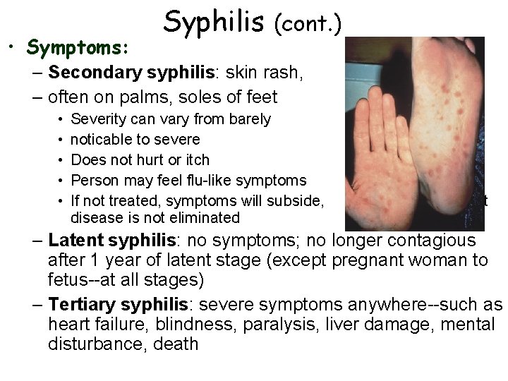  • Symptoms: Syphilis (cont. ) – Secondary syphilis: skin rash, – often on