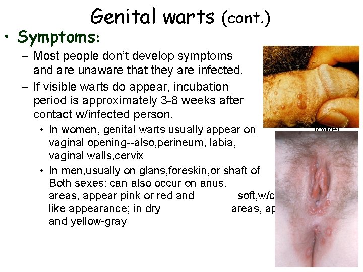 Genital warts • Symptoms: (cont. ) – Most people don’t develop symptoms and are