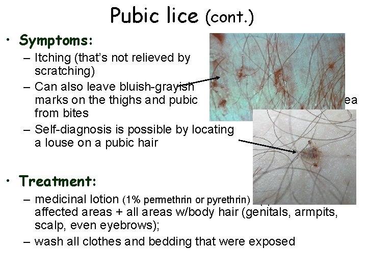 Pubic lice (cont. ) • Symptoms: – Itching (that’s not relieved by scratching) –