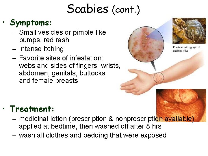  • Symptoms: Scabies (cont. ) – Small vesicles or pimple-like bumps, red rash