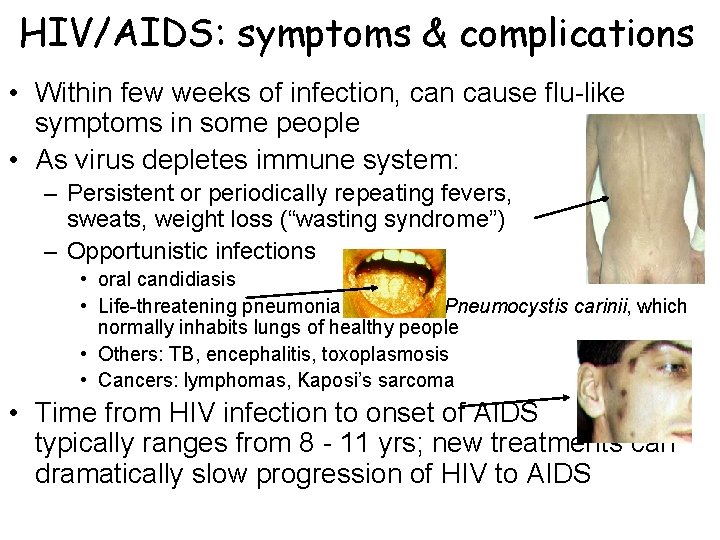 HIV/AIDS: symptoms & complications • Within few weeks of infection, can cause flu-like symptoms