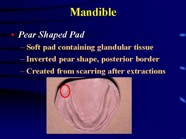 Mandible • Pear Shaped Pad – Soft pad containing glandular tissue – Inverted pear