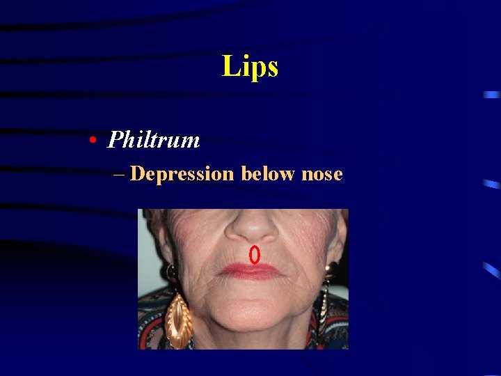 Lips • Philtrum – Depression below nose 