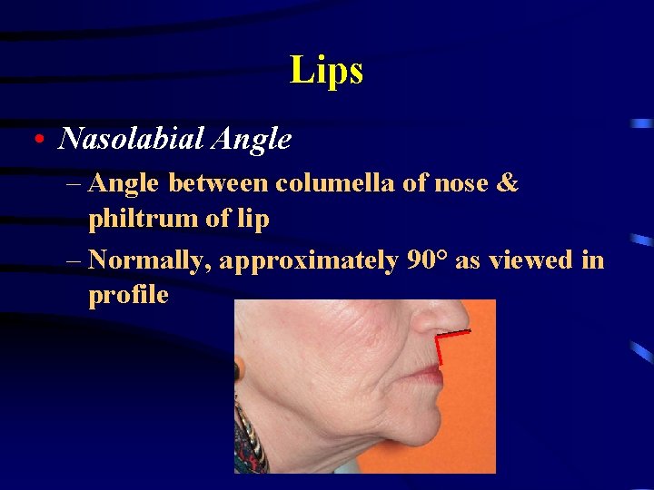 Lips • Nasolabial Angle – Angle between columella of nose & philtrum of lip