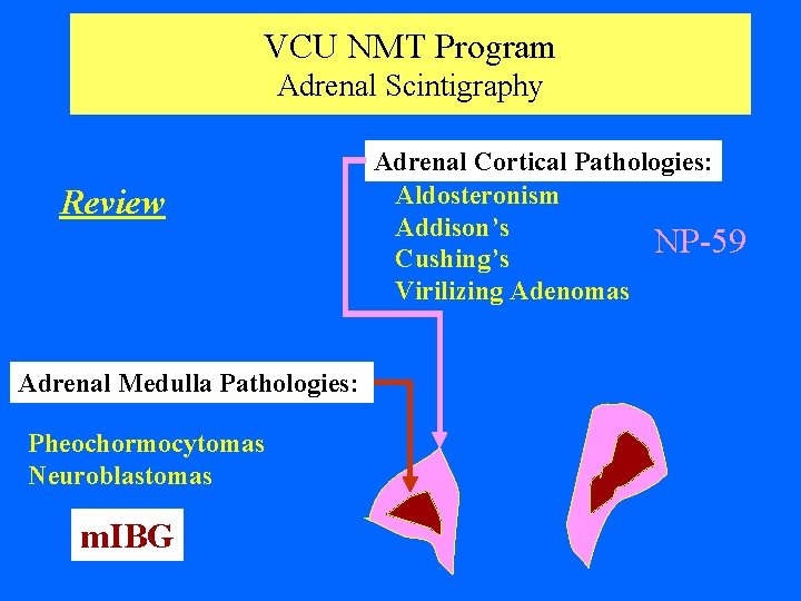 VCU NMT Program Adrenal Scintigraphy Review Adrenal Medulla Pathologies: Pheochormocytomas Neuroblastomas m. IBG Adrenal