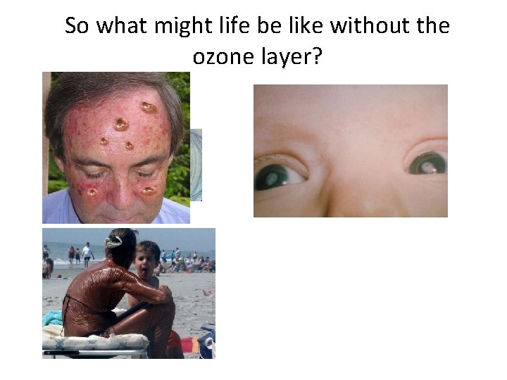 So what might life be like without the ozone layer? So what might life be like without the ozone layer?