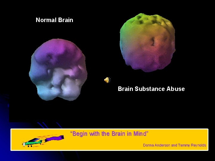 Normal Brain Substance Abuse “Begin with the Brain in Mind” Donna Anderson and Tammy