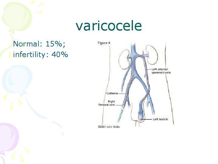 varicocele Normal: 15%; infertility: 40% 