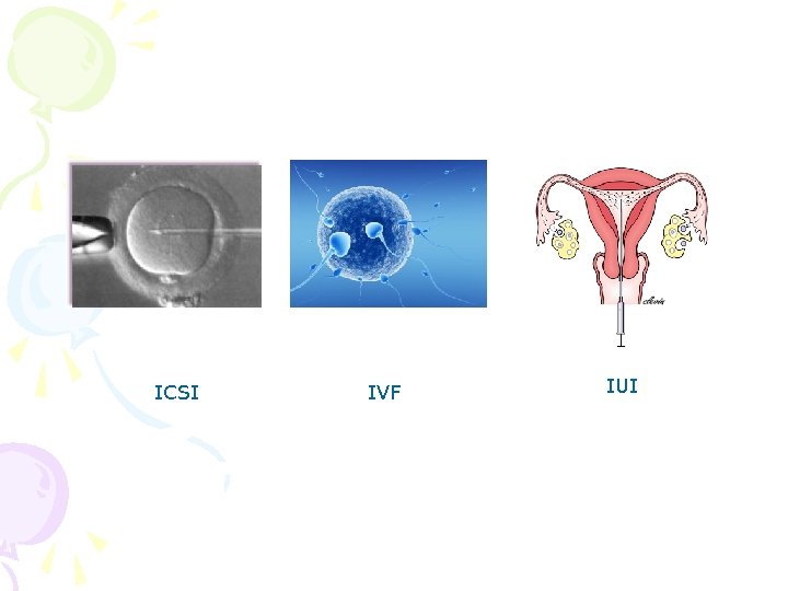 ICSI IVF IUI 