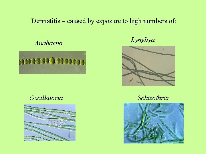 Dermatitis – caused by exposure to high numbers of: Anabaena Oscillatoria Lyngbya Schizothrix 