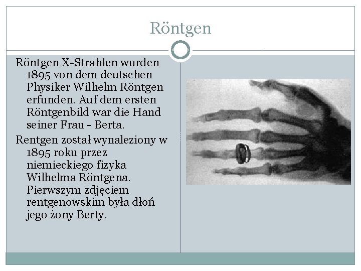 Röntgen X-Strahlen wurden 1895 von dem deutschen Physiker Wilhelm Röntgen erfunden. Auf dem ersten