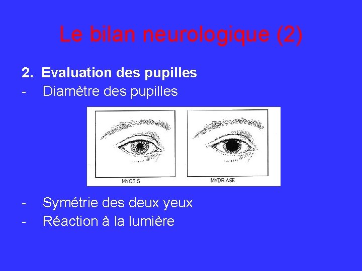 Le bilan neurologique (2) 2. Evaluation des pupilles - Diamètre des pupilles - Symétrie