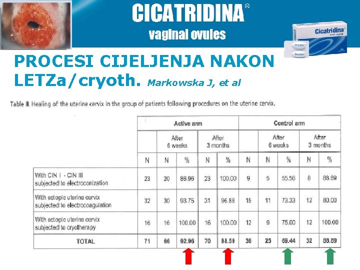 PROCESI CIJELJENJA NAKON LETZa/cryoth. Markowska J, et al 