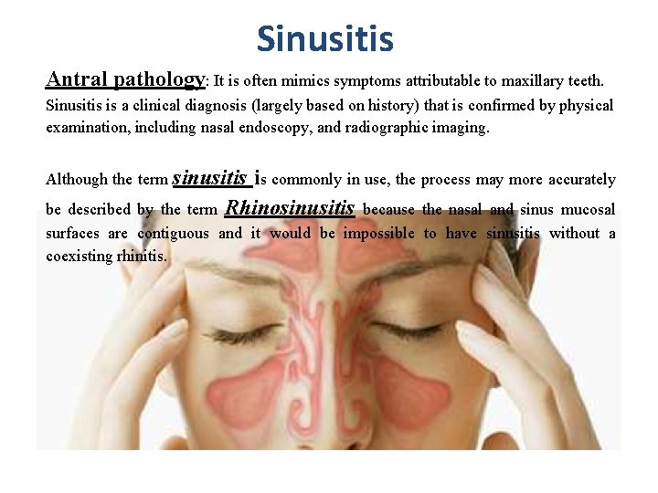 Sinusitis Antral pathology: It is often mimics symptoms attributable to maxillary teeth. Sinusitis is