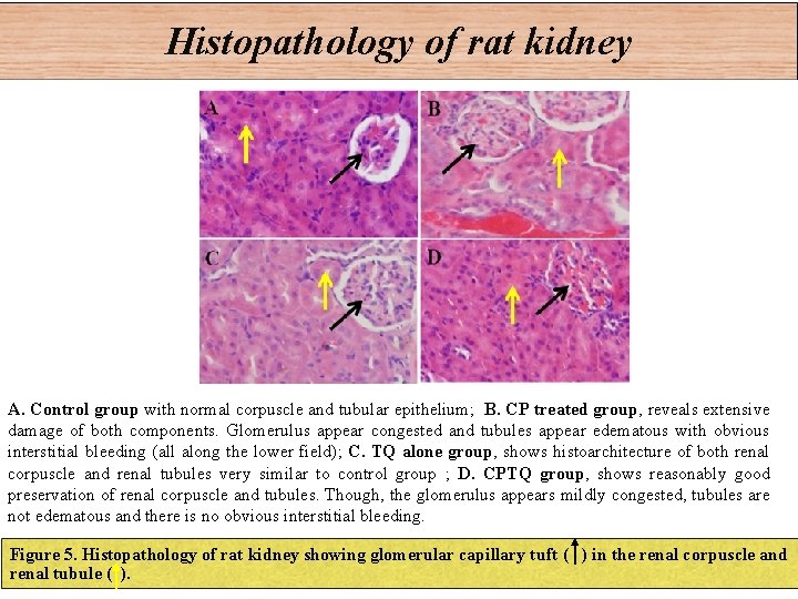 Histopathology of rat kidney A. Control group with normal corpuscle and tubular epithelium; B.