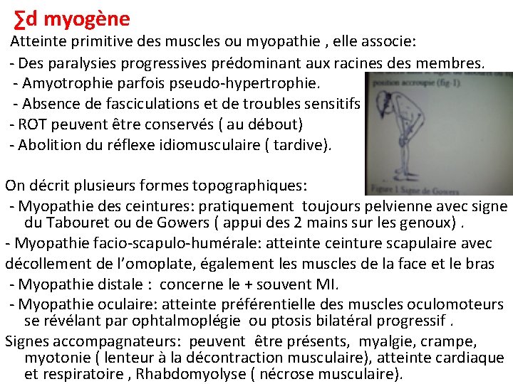 ∑d myogène Atteinte primitive des muscles ou myopathie , elle associe: - Des paralysies