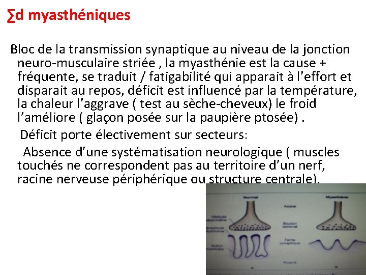 ∑d myasthéniques Bloc de la transmission synaptique au niveau de la jonction neuro-musculaire striée