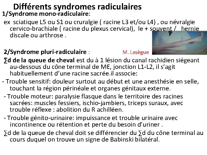 Différents syndromes radiculaires 1/Syndrome mono-radiculaire: ex sciatique L 5 ou S 1 ou cruralgie