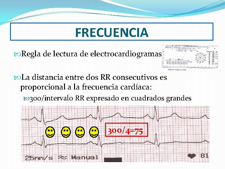 FRECUENCIA Regla de lectura de electrocardiogramas. La distancia entre dos RR consecutivos es proporcional