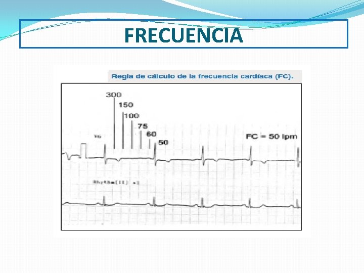 FRECUENCIA 