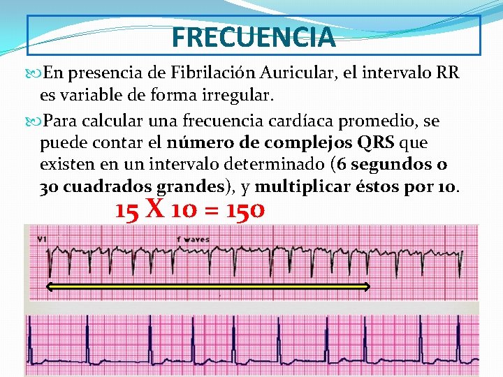 FRECUENCIA En presencia de Fibrilación Auricular, el intervalo RR es variable de forma irregular.