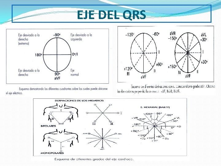 EJE DEL QRS 