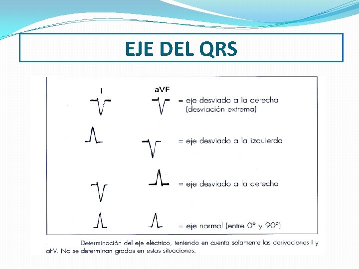 EJE DEL QRS 