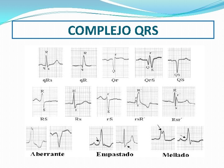 COMPLEJO QRS 