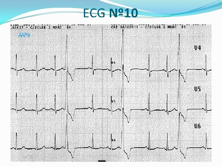 ECG Nº 10 