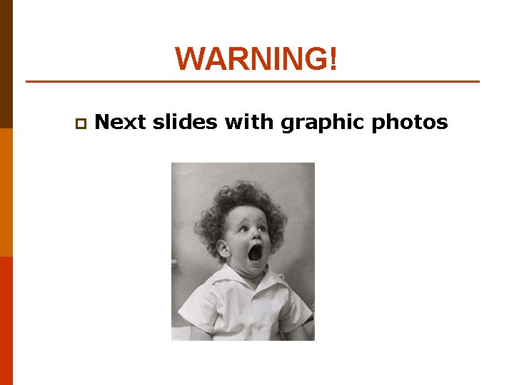 WARNING! p Next slides with graphic photos 