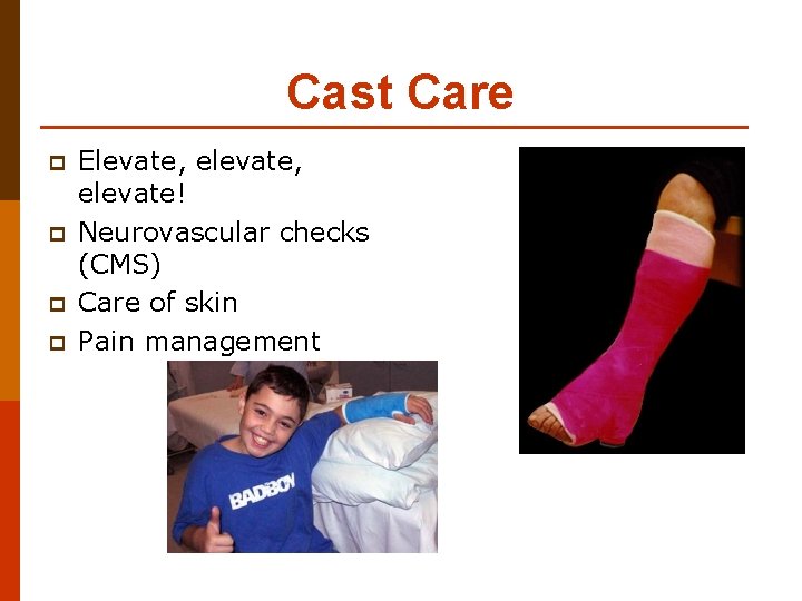 Cast Care p p Elevate, elevate, elevate! Neurovascular checks (CMS) Care of skin Pain