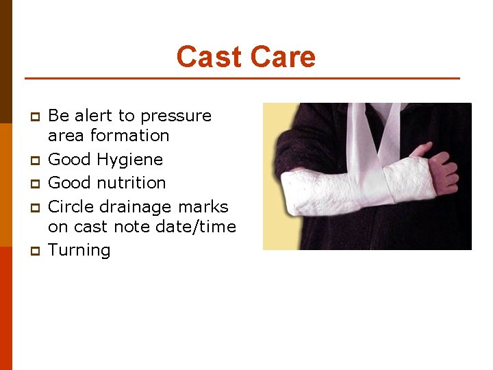 Cast Care p p p Be alert to pressure area formation Good Hygiene Good