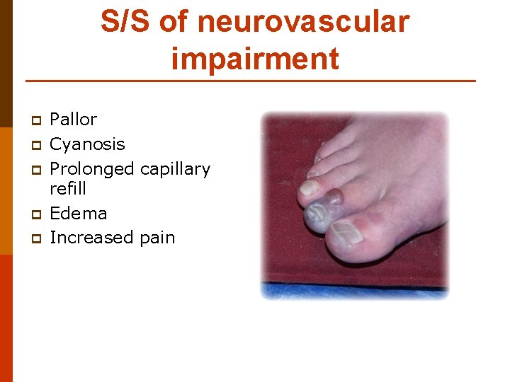 S/S of neurovascular impairment p p p Pallor Cyanosis Prolonged capillary refill Edema Increased