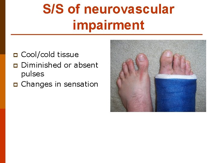 S/S of neurovascular impairment p p p Cool/cold tissue Diminished or absent pulses Changes