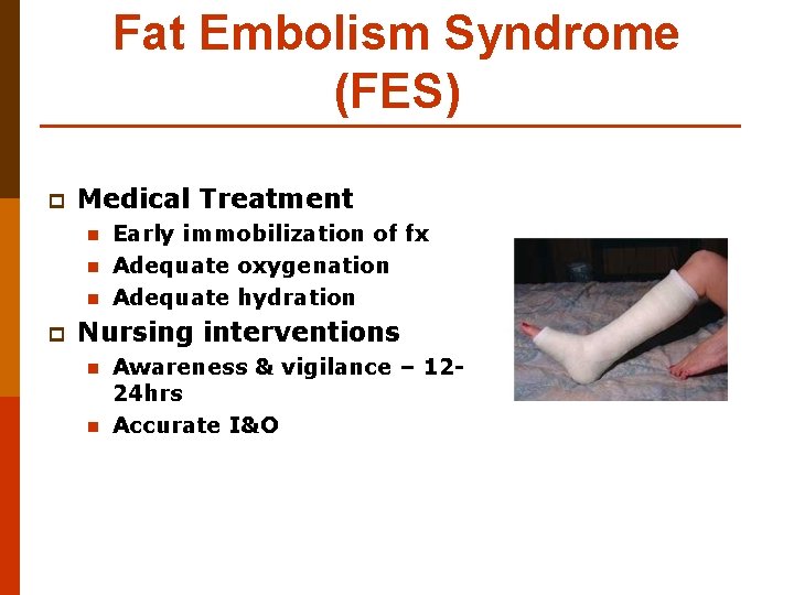 Fat Embolism Syndrome (FES) p Medical Treatment n n n p Early immobilization of