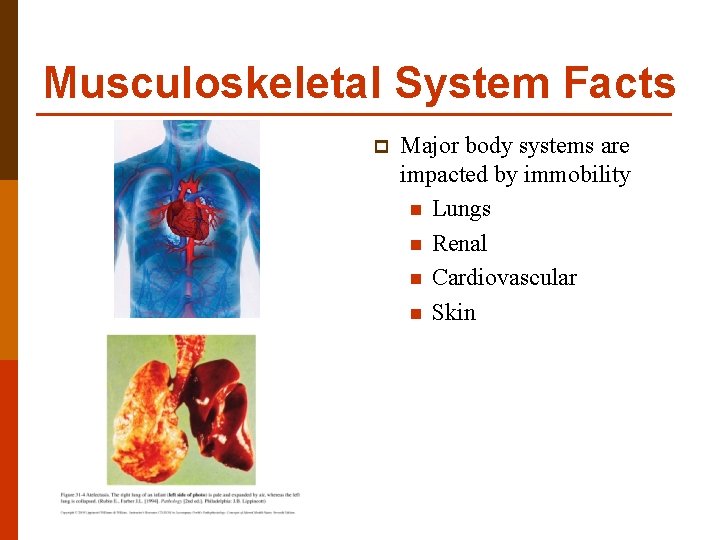 Musculoskeletal System Facts p Major body systems are impacted by immobility n Lungs n