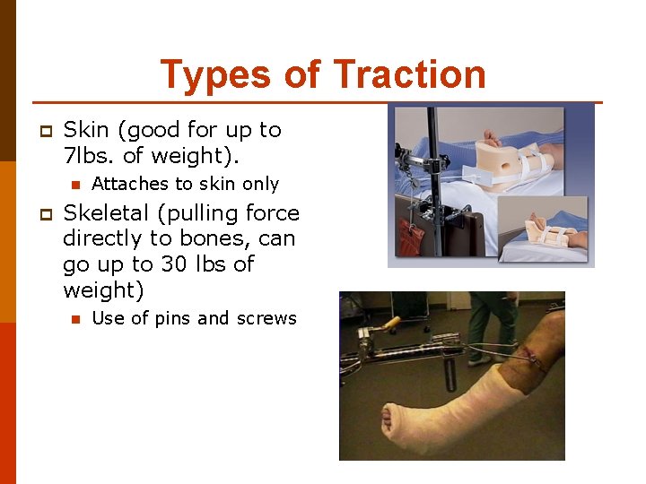 Types of Traction p Skin (good for up to 7 lbs. of weight). n