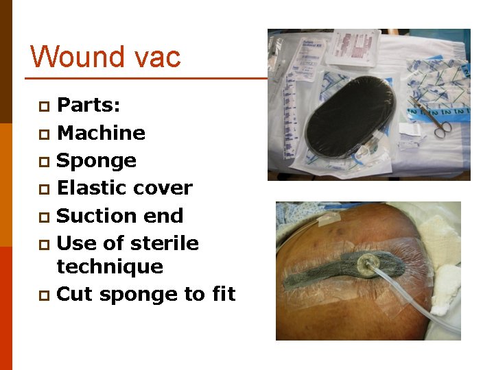 Wound vac Parts: p Machine p Sponge p Elastic cover p Suction end p