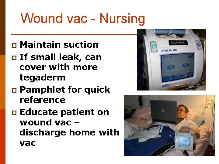 Wound vac - Nursing Maintain suction p If small leak, can cover with more