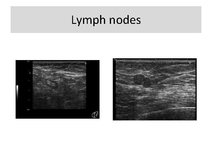Lymph nodes 