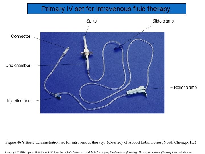 Primary IV set for intravenous fluid therapy. 