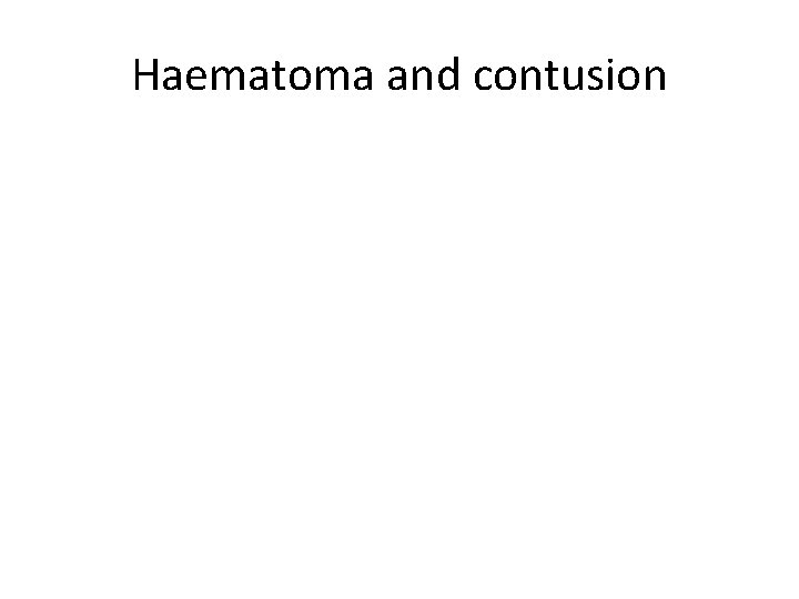 Haematoma and contusion 