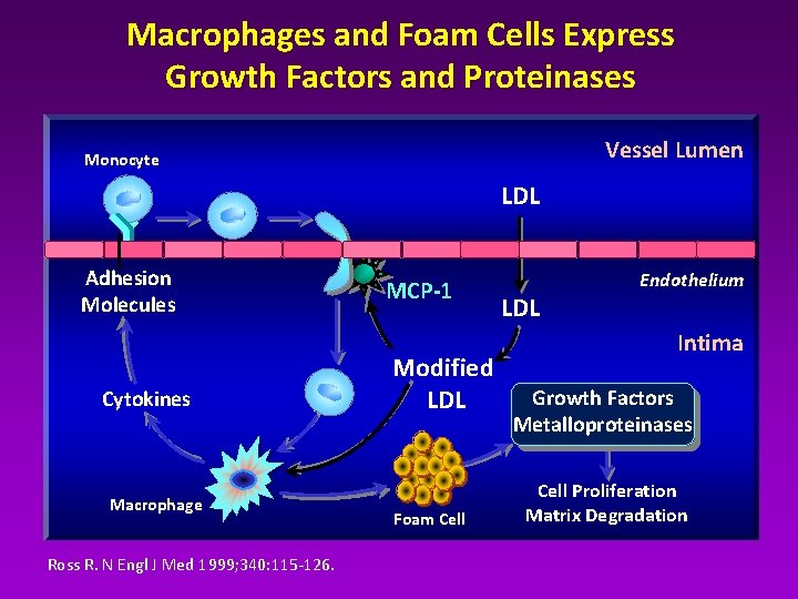 Macrophages and Foam Cells Express Growth Factors and Proteinases Vessel Lumen Monocyte LDL Adhesion