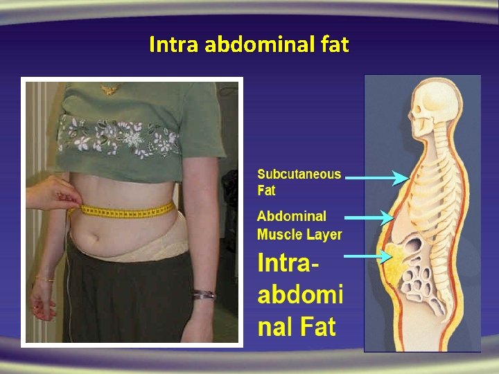 Intra abdominal fat 