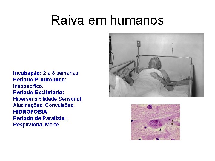 Raiva em humanos Incubação: 2 a 8 semanas Período Prodrômico: Inespecífico. Período Excitatório: Hipersensibilidade