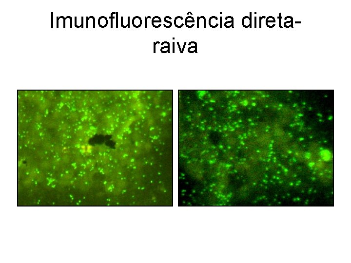 Imunofluorescência direta- raiva 