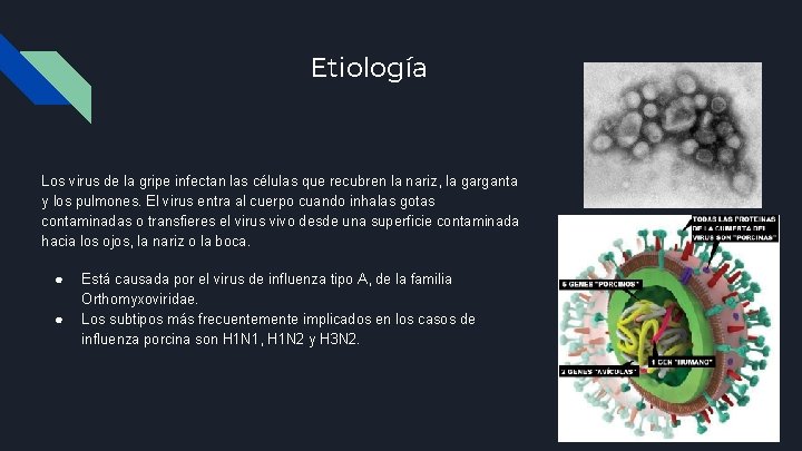 Etiología Los virus de la gripe infectan las células que recubren la nariz, la