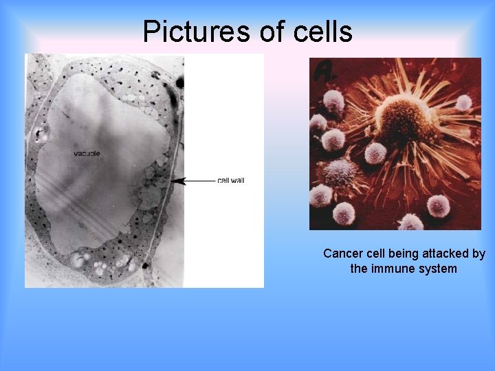 Pictures of cells Cancer cell being attacked by the immune system 