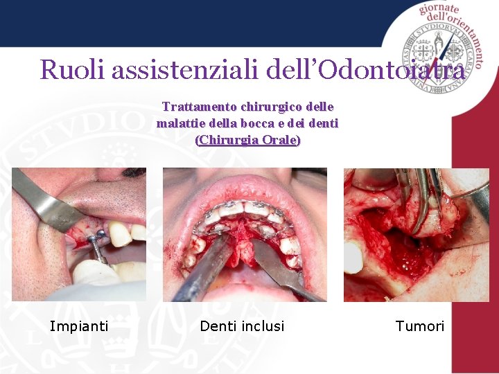 Ruoli assistenziali dell’Odontoiatra Trattamento chirurgico delle malattie della bocca e dei denti (Chirurgia Orale)